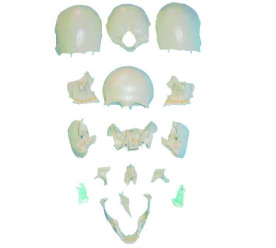 康人分離頭顱骨散骨模型KAR/11117-2