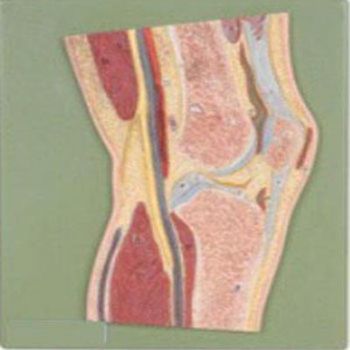 髖關(guān)節(jié)剖面模型KAR/11205