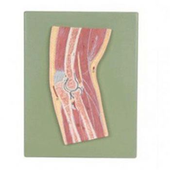 肘關(guān)節(jié)剖面模型KAR/11203