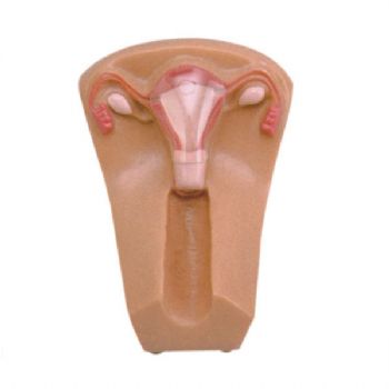 女性宮內(nèi)避孕器及訓(xùn)練模型KAR/B3
