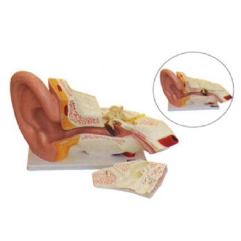 益聯(lián)耳結(jié)構(gòu)放大模型YLM2090