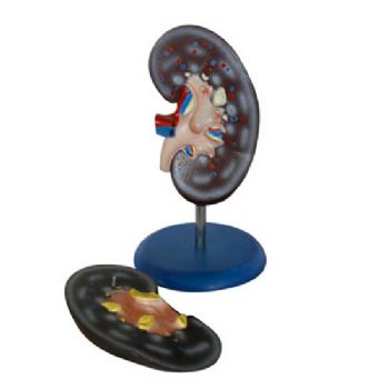 腎臟解剖模型YLM-A14005