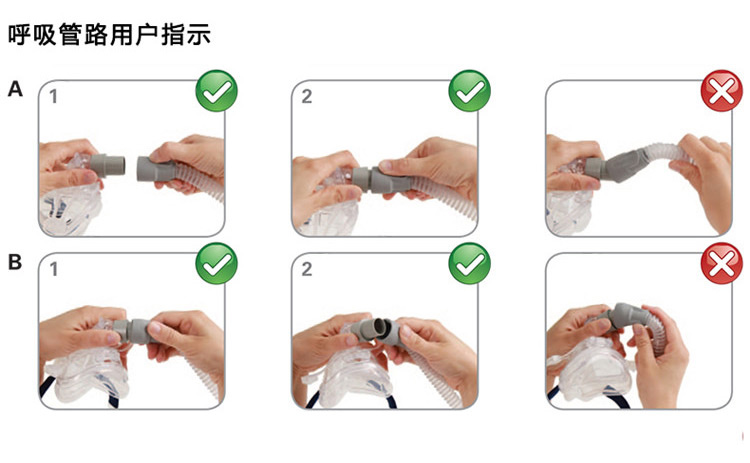瑞思邁呼吸機VPAP IV ST 全自動雙水平 有效治療慢阻肺/肺心病/呼吸功能不全